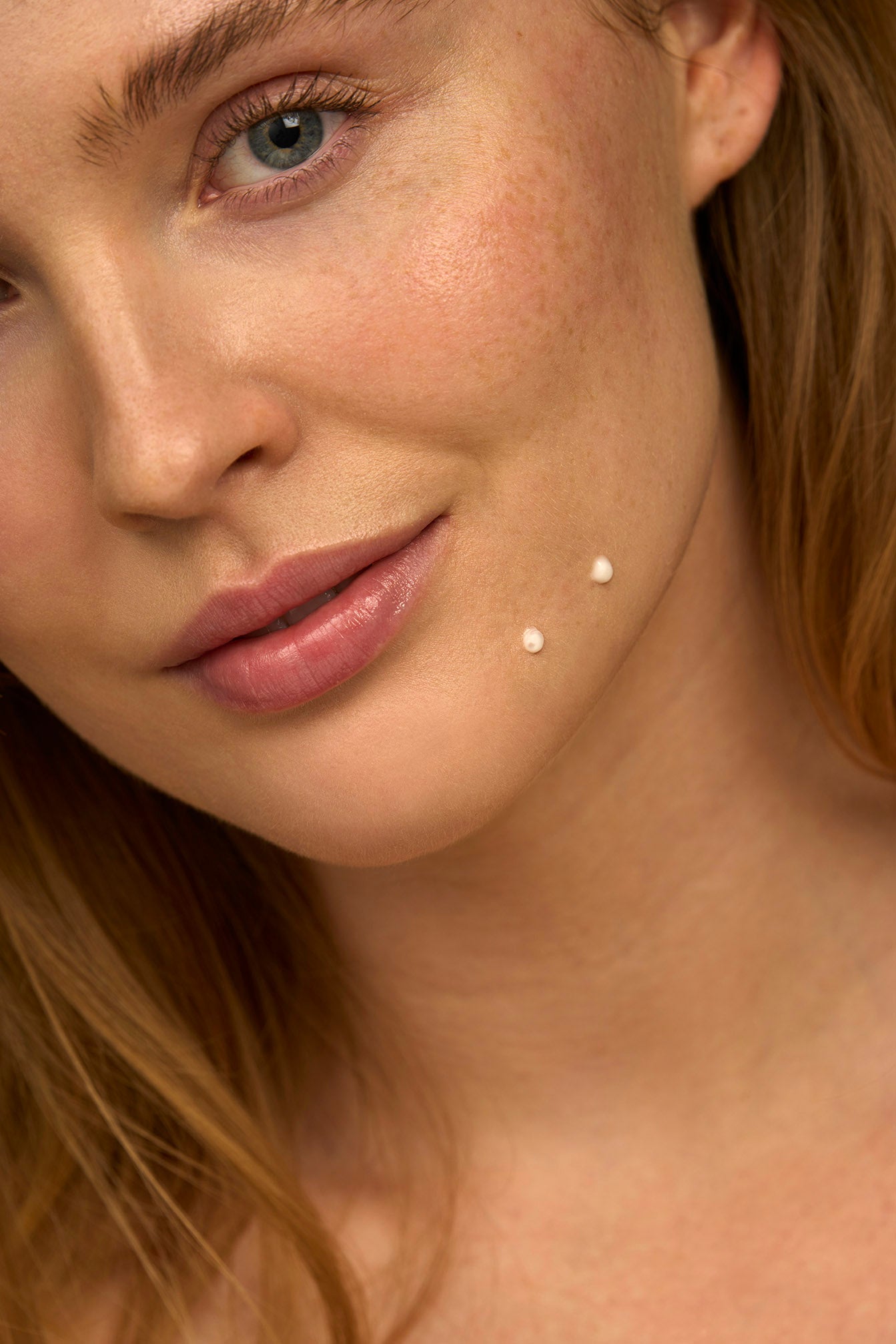 Acne prone skin